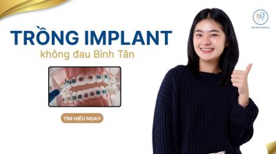 Trồng răng implant kh&ocirc;ng đau quận B&igrave;nh T&acirc;n | PK Đo&agrave;n Gia uy t&iacute;n
