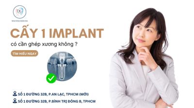 CẤY IMPLANT 1 RĂNG CÓ CẦN GHÉP XƯƠNG KHÔNG?