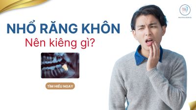 Nhổ răng kh&ocirc;n n&ecirc;n ki&ecirc;ng g&igrave;? Cẩm nang chăm s&oacute;c để vết thương mau l&agrave;nh
