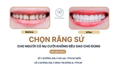 RĂNG SỨ CHO NGƯỜI CÓ NỤ CƯỜI KHÔNG ĐỀU – LÀM SAO CHỌN ĐÚNG DÁNG RĂNG?