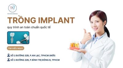 QUY TRÌNH CẤY IMPLANT AN TOÀN ĐẠT CHUẨN QUỐC TẾ
