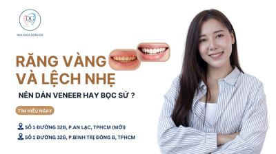 RĂNG Ố VÀNG – RĂNG LỆCH NHẸ NÊN DÁN VENEER HAY BỌC SỨ?