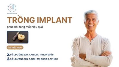 CẤY GHÉP IMPLANT – GIẢI PHÁP PHỤC HỒI RĂNG MẤT HIỆU QUẢ