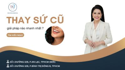 THAY SỨ CŨ XUỐNG MÀU KHI VỀ NƯỚC – GIẢI PHÁP NÀO NHANH NHẤT?