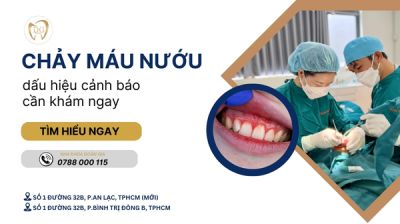 CHẢY MÁU NƯỚU LIÊN TỤC – DẤU HIỆU CẢNH BÁO CẦN KHÁM NGAY