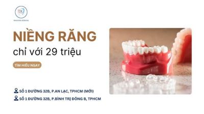 NIỀNG KHAY TRONG SUỐT CHỈ VỚI 29 TRIỆU