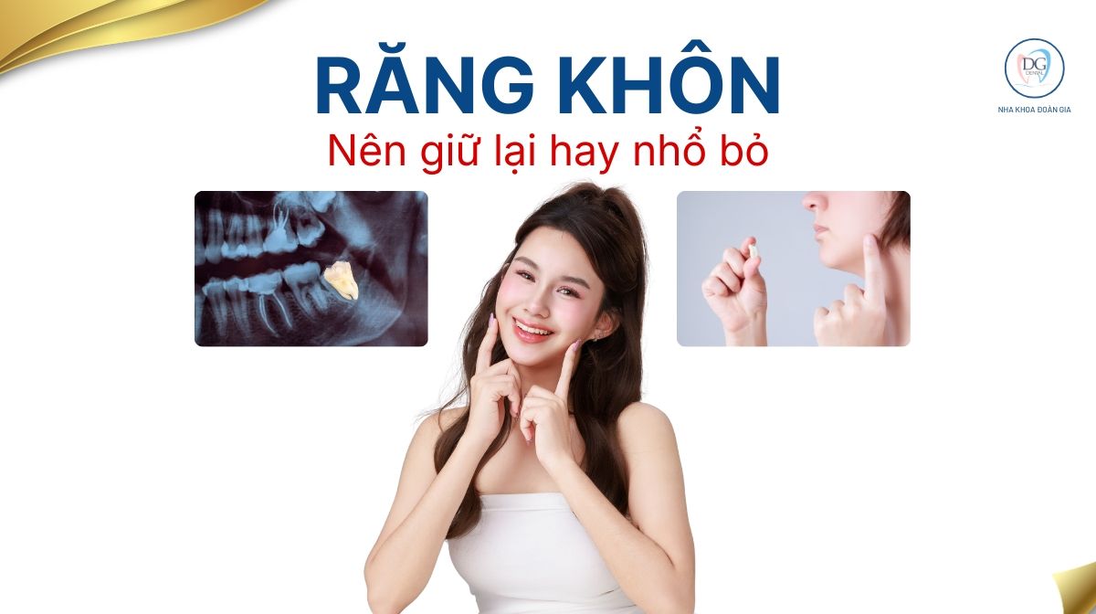 Răng kh&ocirc;n n&ecirc;n nhổ hay giữ lại?