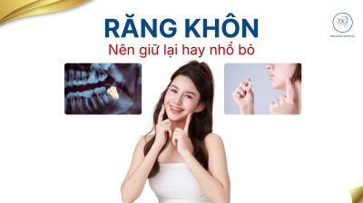Răng kh&ocirc;n n&ecirc;n nhổ hay giữ lại?