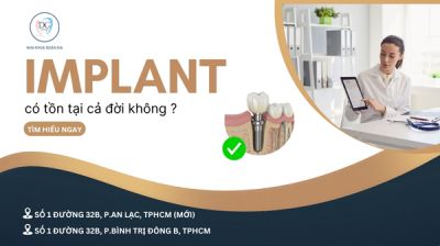 IMPLANT CÓ TỒN TẠI CẢ ĐỜI KHÔNG?