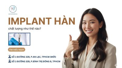 IMPLANT HÀN GIÁ HỢP LÝ – CHẤT LƯỢNG CÓ THUA KÉM LOẠI CAO CẤP?