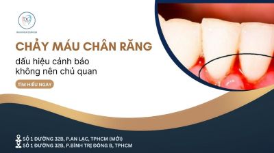 CHẢY MÁU CHÂN RĂNG: DẤU HIỆU CẢNH BÁO BỆNH LÝ BẠN KHÔNG NÊN CHỦ QUAN