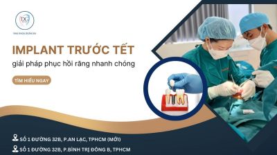 TRỒNG IMPLANT TRƯỚC TẾT – GIẢI PHÁP PHỤC HỒI RĂNG NHANH CHÓNG