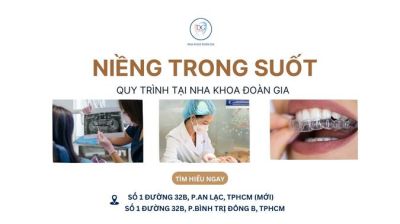 TRÌNH TỰ NIỀNG RĂNG TRONG SUỐT TẠI PHÒNG NHA UY TÍN