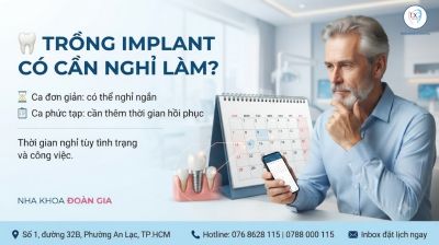 Trồng Implant C&oacute; Cần Nghỉ L&agrave;m Kh&ocirc;ng? Bao L&acirc;u C&oacute; Thể Đi L&agrave;m?