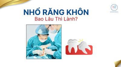 NHỔ RĂNG KH&Ocirc;N BAO L&Acirc;U TH&Igrave; L&Agrave;NH ?