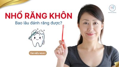 Nhổ răng kh&ocirc;n bao l&acirc;u th&igrave; đ&aacute;nh răng được? Hướng dẫn vệ sinh an to&agrave;n từ chuy&ecirc;n gia