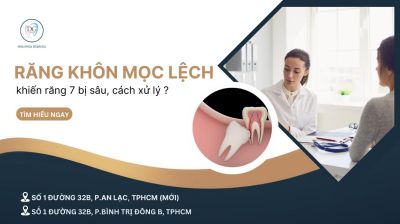 RĂNG KHÔN MỌC LỆCH KHIẾN RĂNG 7 BỊ SÂU – CÁCH XỬ LÝ TRIỆT ĐỂ