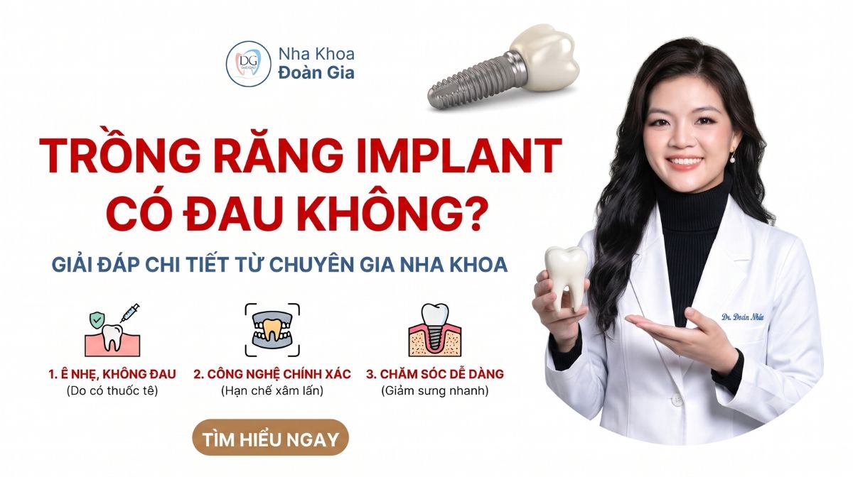 Trồng Răng Implant C&oacute; Đau Kh&ocirc;ng? Giải Đ&aacute;p Chi Tiết Từ Chuy&ecirc;n Gia Nha Khoa