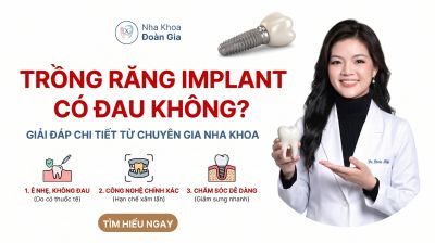 Trồng Răng Implant C&oacute; Đau Kh&ocirc;ng? Giải Đ&aacute;p Chi Tiết Từ Chuy&ecirc;n Gia Nha Khoa