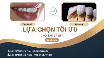 RĂNG SỨ VÀ VENEER KHÁC NHAU NHƯ THẾ NÀO? LỰA CHỌN NÀO TỐT HƠN CHO BẠN?