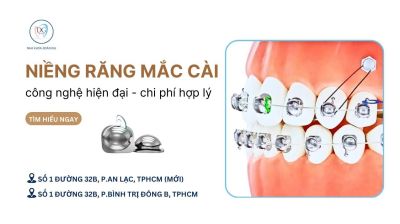 NIỀNG RĂNG MẮC CÀI CÁNH CAM – CÔNG NGHỆ HIỆN ĐẠI VỚI CHI PHÍ HỢP LÝ