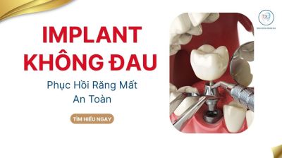 IMPLANT GIẢI PH&Aacute;P PHỤC HỒI RĂNG MẤT AN TO&Agrave;N