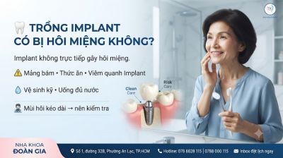 Trồng Implant C&oacute; Bị H&ocirc;i Miệng Kh&ocirc;ng? Nguy&ecirc;n Nh&acirc;n V&agrave; C&aacute;ch Xử L&yacute;?