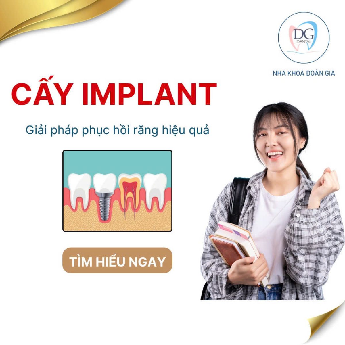 CẤY IMPLANT - GIẢI PH&Aacute;P PHỤC HỒI RĂNG HIỆU QUẢ