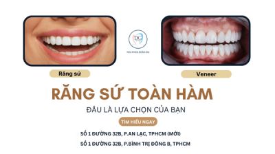 VIỆT KIỀU LÀM RĂNG TOÀN HÀM – NÊN CHỌN DÁN VENEER HAY BỌC SỨ?