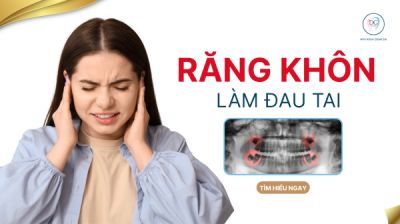 RĂNG KH&Ocirc;N C&Oacute; L&Agrave;M ĐAU TAI ?