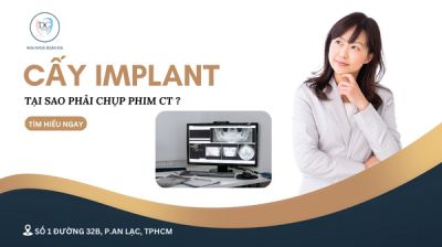 TẠI SAO TRỒNG IMPLANT PHẢI CHỤP PHIM CT