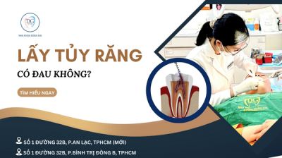 LẤY TỦY RĂNG CÓ ĐAU KHÔNG? KHI NÀO THÌ CẦN LẤY TỦY?
