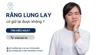 RĂNG LUNG LAY DO VIÊM NHA CHU – CÓ GIỮ LẠI ĐƯỢC KHÔNG?
