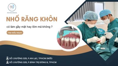 &quot;NHỔ RĂNG KHÔN CÓ LÀM GẦY MẶT HAY LÕM MÁ KHÔNG? &quot;
