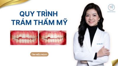Quy tr&igrave;nh tr&aacute;m răng s&acirc;u (h&agrave;n răng) thẩm mỹ bằng Composite