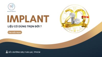 Trồng Implant có dùng được trọn đời hay không?