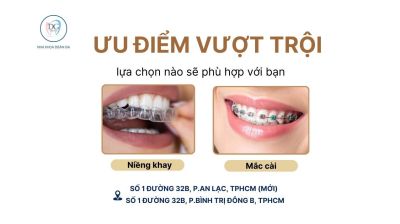SO SÁNH NIỀNG KHAY TRONG SUỐT VÀ MẮC CÀI: LỰA CHỌN NÀO PHÙ HỢP?