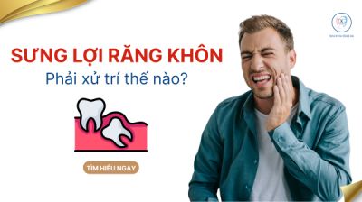 SƯNG LỢI RĂNG KH&Ocirc;N PHẢI L&Agrave;M SAO ?