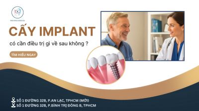 CẤY IMPLANT RỒI C&Oacute; CẦN ĐIỀU TRỊ VỀ SAU KH&Ocirc;NG?