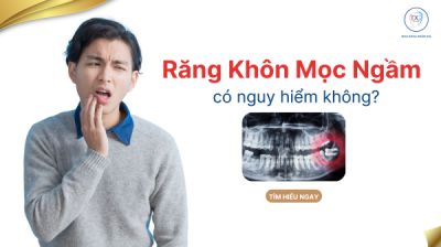 RĂNG KH&Ocirc;N MỌC NGẦM C&Oacute; NGUY HIỂM KH&Ocirc;NG ?