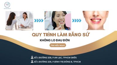 QUY TRÌNH LÀM RĂNG SỨ TẠI NHA KHOA – TỪNG BƯỚC KHÔNG LO ĐAU ĐỚN