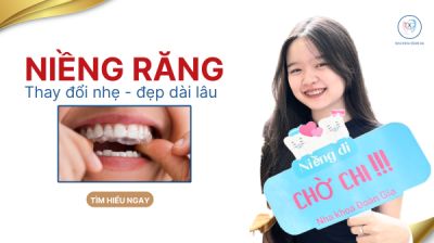 NIỀNG RĂNG C&Oacute; GIỮ ĐƯỢC VĨNH VIỄN KH&Ocirc;NG? C&Aacute;CH DUY TR&Igrave; KẾT QUẢ
