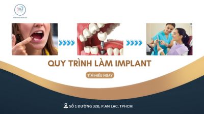 Trồng răng Implant có đau không? Có nguy hiểm không?