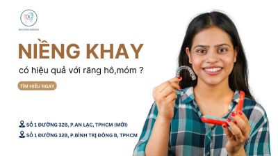 NIỀNG KHAY CÓ HIỆU QUẢ VỚI RĂNG HÔ, MÓM NẶNG KHÔNG?