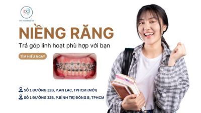 TRẢ GÓP LINH HOẠT VỚI NIỀNG RĂNG MẮC CÀI CÁNH CAM