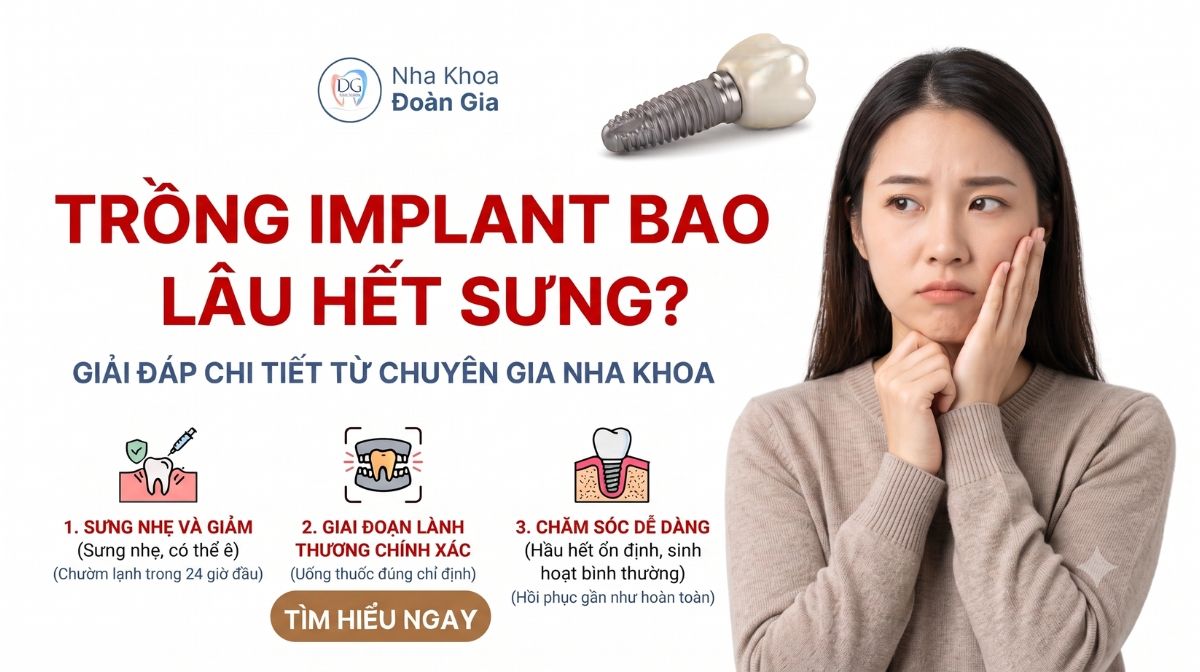 Trồng Implant Bao L&acirc;u Hết Sưng? Giải Đ&aacute;p Chi Tiết Từ Chuy&ecirc;n Gia Nha Khoa