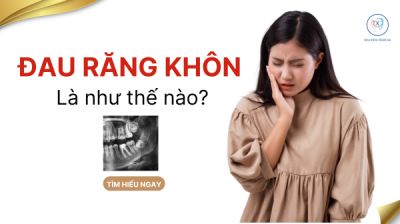 ĐAU RĂNG KH&Ocirc;N L&Agrave; G&Igrave; ?