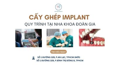 QUY TRÌNH CẤY IMPLANT HÀN QUỐC AN TOÀN TẠI NHA KHOA UY TÍN