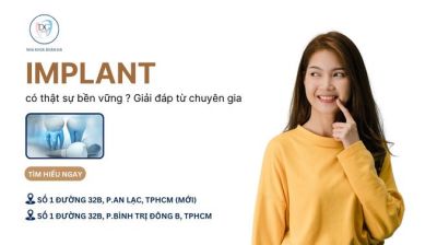 IMPLANT CÓ THẬT SỰ BỀN VỮNG SUỐT ĐỜI? GIẢI ĐÁP TỪ CHUYÊN GIA