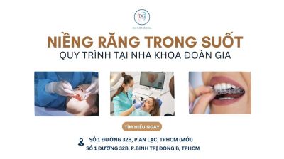 QUY TRÌNH NIỀNG RĂNG KHAY TRONG SUỐT TẠI PHÒNG NHA UY TÍN
